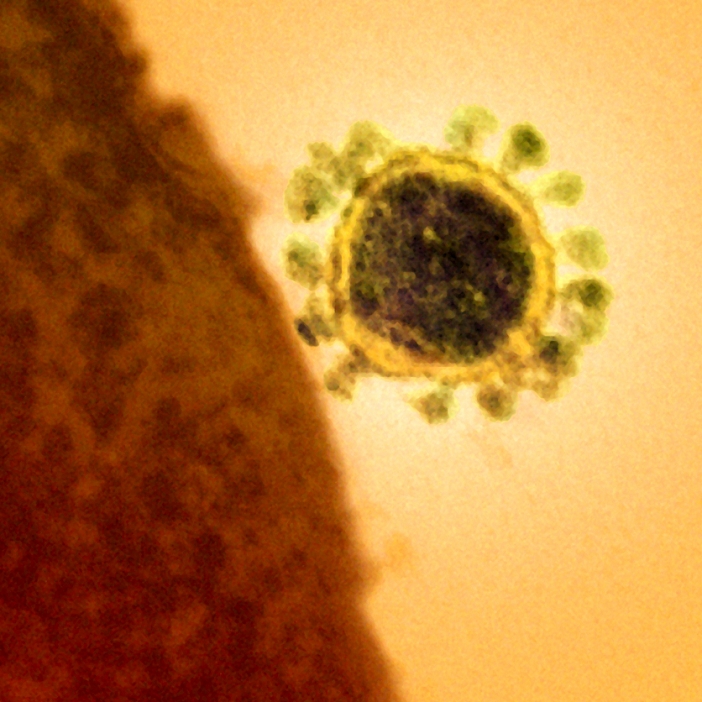 Middle East Respiratory Syndrome  MERS Micrograph of virus  Date taken unknown  MERS coronavirus particle. Transmission electron micrograph  TEM  of a section through a Middle East Respiratory Syndrome Coronavirus  MERS CoV  particle  virion, round . Formerly known as novel coronavirus, MERS was first identified in Saudi Arabia in 2012. Most people infected with MERS develop severe acute respiratory illness with symptoms of fever, cough, and shortness of breath. As of May 2014, there have been 571 confirmed cases including 171 deaths. The virus has been reported in 18 countries.