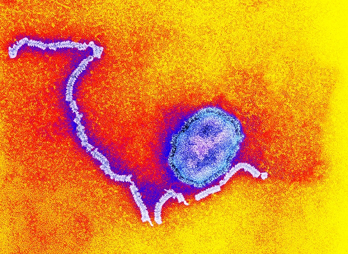 Measles Virus  Electron micrograph   Date of photograph unknown  Measles virus particle, coloured transmission electron micrograph  TEM . This virus, from the Morbillivirus group of viruses, consists of an RNA  ribonucleic acid  core surrounded by a envelope studded with surface proteins, which are used to attach to and penetrate a host cell. Measles is a highly infectious itchy rash with a fever. It mainly affects children, but one attack usually gives life long immunity.