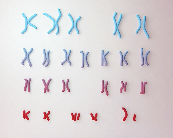 Karyotype showing the arrangement of chromosomes in a female with Down's syndrome (trisomy-21), the most common diagnosable cause of mental handicap, computer illustration. Down's syndrome is caused by a chromosomal anomaly: the 21st set having three rather than the normal two chromosomes. In karyotyping, chromosomes are arranged in numbered pairs according to a standard classification. The female set differs from the male in the sex pair (bottom right); a male would have XY rather than XX. A female Down's karyotype is written: 47,XX,+21. The normal chromosome count is 46, 23 from maternal and 23 from paternal origin. Unlabelled illustration
