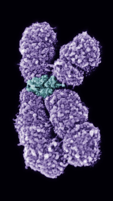 chromosome 10 Human chromosome 10, coloured scanning electron micrograph  SEM . Chromosomes are a packaged form of the genetic material DNA  deoxyribonucleic acid , and form during cell replication. Each consists of two identical, parallel strands  chromatids, left and right , joined at an area called a centromere  centre, green . Humans have 23 pairs of chromosomes. This is chromosome 10, which carries between 800 and 1200 genes. Gene defects on this chromosome are related to diseases such as Usher syndrome, non syndromic deafness, and a form of porphyria. Magnification: x25,000 when printed 10 centimetres tall. 