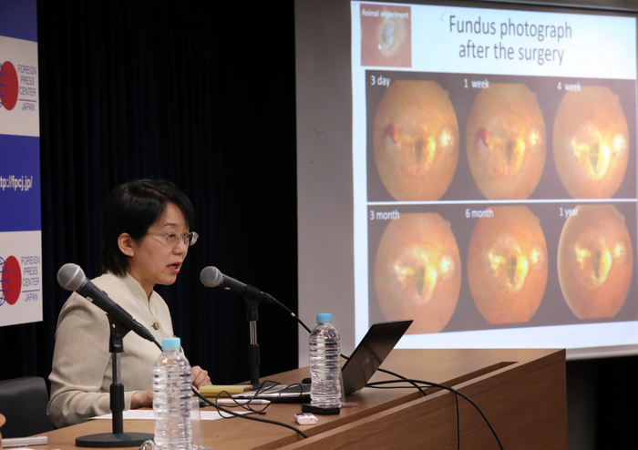 RIKEN s Takahashi holds press conference to discuss prospects for iPS clinical research June 7, 2017, Tokyo, Japan   Masayo Takahashi, project leader for retinal regeneration laboratory, Riken Center for Developmental Biology pseaks before foreign journalist at the Foreign Press Center in Tokyo on Wednesday, June 7, 2017. The world s first transplant surgery using iPS cells from a donor was carried successfully in March.    Photo by Yoshio Tsunoda AFLO  LwX  ytd 